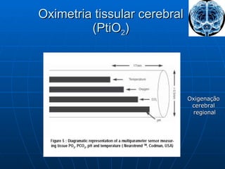 Oximetria tissular cerebral (PtiO 2 ) Oxigenação  cerebral  regional 