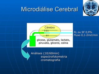 Microdiálise Cerebral glicose, glutamato, lactato, piruvato, glicerol, colina   Análises (10/60min) espectrofotometria cromatografia RL ou SF 0,9% Fluxo 0,1-2mcl/min 