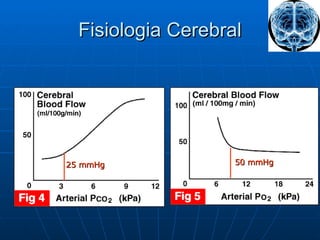 Fisiologia Cerebral 25 mmHg 50 mmHg 