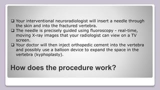 How does the procedure work?
 Your interventional neuroradiologist will insert a needle through
the skin and into the fractured vertebra.
 The needle is precisely guided using fluoroscopy - real-time,
moving X-ray images that your radiologist can view on a TV
screen.
 Your doctor will then inject orthopedic cement into the vertebra
and possibly use a balloon device to expand the space in the
vertebra (kyphoplasty).
 
