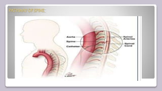 PATHWAY OF SPINE:
 