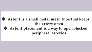 ❖ Astent is a small metal mesh tube that keeps
the artery open
❖ Astent placement is a way to open blocked
peripheral arteries
 