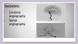 DIAGNOSTIC:
1. Cerebral
angiography
2. Spinal
angiography
 