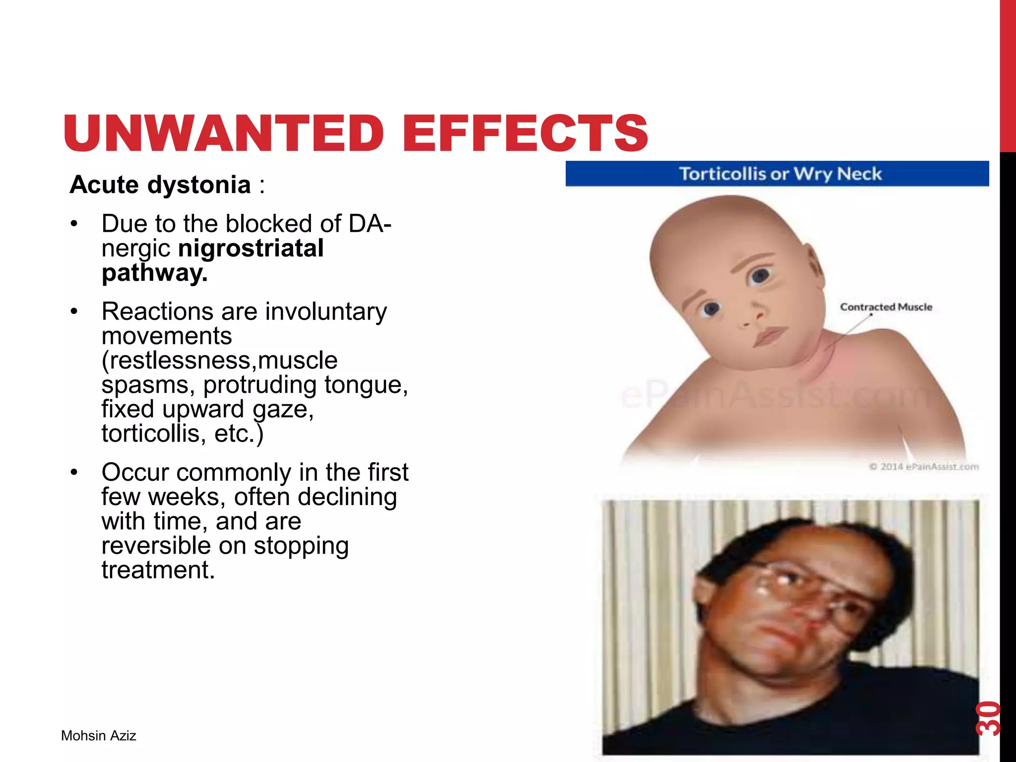 UNWANTED EFFECTS
Acute dystonia :
• Due to the blocked of DA-
nergic nigrostriatal
pathway.
• Reactions are involuntary
movements
(restlessness,muscle
spasms, protruding tongue,
fixed upward gaze,
torticollis, etc.)
• Occur commonly in the first
few weeks, often declining
with time, and are
reversible on stopping
treatment.
Mohsin Aziz
30
 