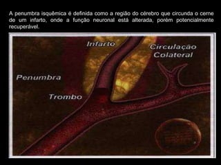 A penumbra isquêmica é definida como a região do cérebro que circunda o cerne de um infarto, onde a função neuronal está alterada, porém potencialmente recuperável. 