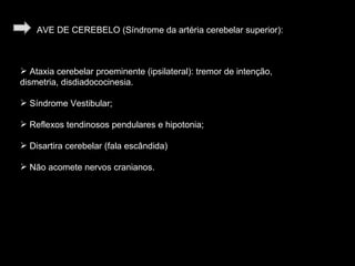 AVE DE CEREBELO (Síndrome da artéria cerebelar superior): Ataxia cerebelar proeminente (ipsilateral): tremor de intenção, dismetria, disdiadococinesia. Síndrome Vestibular; Reflexos tendinosos pendulares e hipotonia; Disartira cerebelar (fala escândida) Não acomete nervos cranianos. 