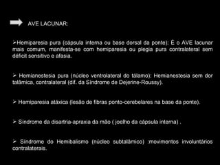 AVE LACUNAR: Hemiparesia pura (cápsula interna ou base dorsal da ponte): É o AVE lacunar mais comum, manifesta-se com hemiparesia ou plegia pura contralateral sem déficit sensitivo e afasia. Hemianestesia pura (núcleo ventrolateral do tálamo): Hemianestesia sem dor talâmica, contralateral (dif. da Síndrome de Dejerine-Roussy). Hemiparesia atáxica (lesão de fibras ponto-cerebelares na base da ponte). Síndrome da disartria-apraxia da mão ( joelho da cápsula interna) . Síndrome do Hemibalismo (núcleo subtalâmico) :movimentos involuntários contralaterais. 
