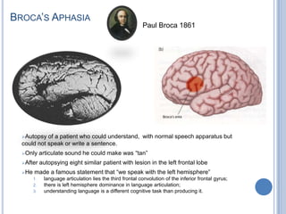 Broca’s AphasiaPaul Broca 1861Autopsy of a patient who could understand,  with normal speech apparatus but could not speak or write a sentence. 