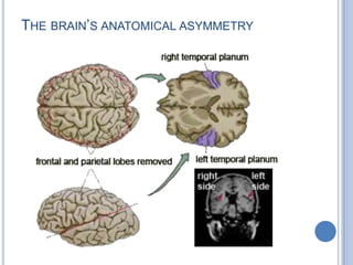 The Wernicke-Geschwind Model of LanguageBAMV