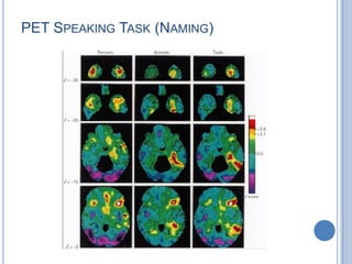 The inferior parietal lobule is one of the last structures of the human brain to have developed in the course of evolutionArea 24: Initiation and maintenance of speechThey are also important to attention and emotion and thus can influence many higher functions. 