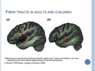 What is gained from recent neuroscience research? At the semantic level, language is ‘woven into action’Motor and sensory systems activation demonstrates semantic categories along brain dimensionsIn the vicinity of sensorimotor domains, may play a role in abstract semantic processing and in general meaning access.