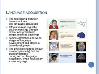 Language acquisitionThe relationship between brain structures and language acquisitionInfants from all linguistic environments go through similar and predictable stages (such as babbling), To find correlations between stages of language development and stages of brain development. The physical changes (known as neuroplasticity) that the brain undergoes during second language acquisition, when adults learn a new language.