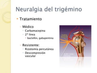 Neuralgia del trigémino
   Tratamiento

    ◦ Médico
      Carbamacepina
      2ª línea
        baclofén, gabapentina


    ◦ Resistente:
      Rizotomía percutánea
      Descompresión
       vascular
 