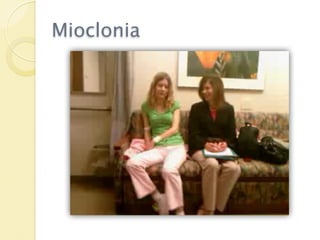 Mioclonia
 
