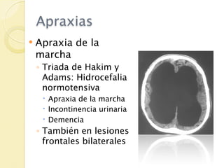 Apraxias
   Apraxia de la
    marcha
    ◦ Triada de Hakim y
      Adams: Hidrocefalia
      normotensiva
      Apraxia de la marcha
      Incontinencia urinaria
      Demencia
    ◦ También en lesiones
      frontales bilaterales
 