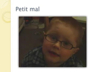 Petit mal
 