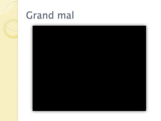 Grand mal
 