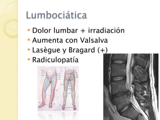 Lumbociática
 Dolor lumbar + irradiación
 Aumenta con Valsalva
 Lasègue y Bragard (+)
 Radiculopatía
 