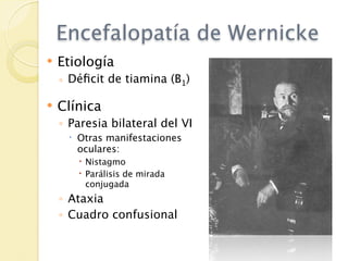Encefalopatía de Wernicke
   Etiología
    ◦ Déﬁcit de tiamina (B1)

   Clínica
    ◦ Paresia bilateral del VI
      Otras manifestaciones
       oculares:
        Nistagmo
        Parálisis de mirada
         conjugada
    ◦ Ataxia
    ◦ Cuadro confusional
 