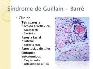 Síndrome de Guillain - Barré
      Clínica
       ◦ Tetraparesia
         ﬂáccida arreﬂéxica
         Ascendente
         Simétrica
       ◦ Paresia facial
         bilateral
         Respeta MOE
       ◦ Parestesias distales
       ◦ Síntomas
         autonómicos
         Taquiacardia
         Ortostatismo ó HTA
 