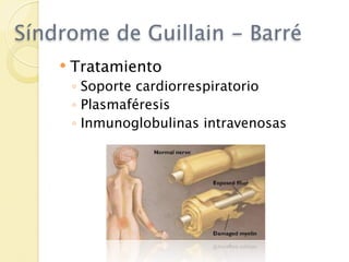 Síndrome de Guillain - Barré
       Tratamiento
        ◦ Soporte cardiorrespiratorio
        ◦ Plasmaféresis
        ◦ Inmunoglobulinas intravenosas
 