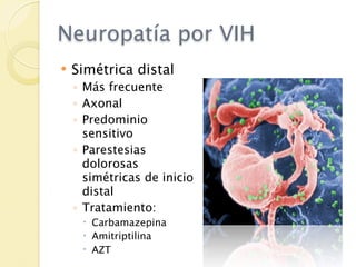Neuropatía por VIH
   Simétrica distal
    ◦ Más frecuente
    ◦ Axonal
    ◦ Predominio
      sensitivo
    ◦ Parestesias
      dolorosas
      simétricas de inicio
      distal
    ◦ Tratamiento:
      Carbamazepina
      Amitriptilina
      AZT
 