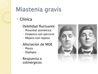 Miastenia gravis
   Clínica
    ◦ Debilidad ﬂuctuante
      Proximal asimétrica
      Empeora con ejercicio
      Mejora con reposo

    ◦ Afectación de MOE
      Ptosis
      Diplopia

    ◦ Respuesta a
      colinérgicos
 