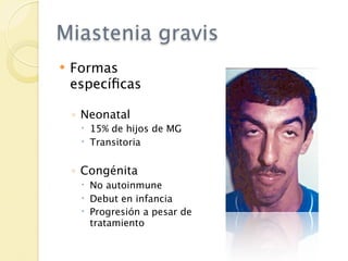 Miastenia gravis
   Formas
    especíﬁcas

    ◦ Neonatal
      15% de hijos de MG
      Transitoria


    ◦ Congénita
      No autoinmune
      Debut en infancia
      Progresión a pesar de
       tratamiento
 
