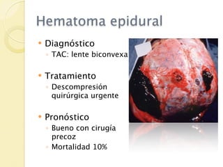 Hematoma epidural
   Diagnóstico
    ◦ TAC: lente biconvexa

   Tratamiento
    ◦ Descompresión
      quirúrgica urgente

   Pronóstico
    ◦ Bueno con cirugía
      precoz
    ◦ Mortalidad 10%
 