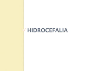 HIDROCEFALIA
 