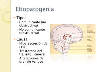 Etiopatogenia
   Tipos
    ◦ Comunicante (no
      obstructiva)
    ◦ No comunicante
      (obstructiva)
   Causa
    ◦ Hipersecreción de
      LCR
    ◦ Trastornos del
      tránsito licuorral
    ◦ Alteraciones del
      drenaje venoso
 