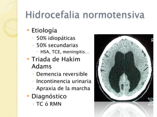 Hidrocefalia normotensiva
   Etiología
    ◦ 50% idiopáticas
    ◦ 50% secundarias
      HSA, TCE, meningitis…
   Triada de Hakim
    Adams
    ◦ Demencia reversible
    ◦ Incontinencia urinaria
    ◦ Apraxia de la marcha
   Diagnóstico
    ◦ TC ó RMN
 