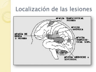 Localización de las lesiones
 