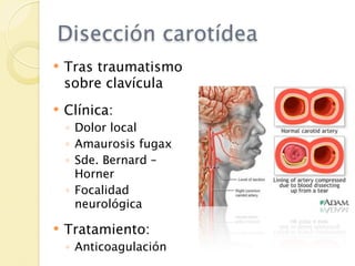 Disección carotídea
   Tras traumatismo
    sobre clavícula
   Clínica:
    ◦ Dolor local
    ◦ Amaurosis fugax
    ◦ Sde. Bernard –
      Horner
    ◦ Focalidad
      neurológica

   Tratamiento:
    ◦ Anticoagulación
 