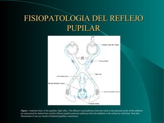 FISIOPATOLOGIA DEL REFLEJO PUPILAR Figure. -  Anatomic basis of the pupillary light reflex. The afferent visual pathways from the retina to the pretectal nuclei of the midbrain are represented by dashed lines and the efferent pupilloconstrictor pathways from the midbrain to the retinas by solid lines. Note that illumination of one eye results in bilateral pupillary constriction. 