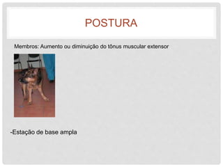 POSTURA 
Membros: Aumento ou diminuição do tônus muscular extensor 
-Estação de base ampla 
 