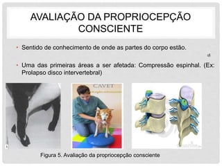 AVALIAÇÃO DA PROPRIOCEPÇÃO 
CONSCIENTE 
• Sentido de conhecimento de onde as partes do corpo estão. 
• Uma das primeiras áreas a ser afetada: Compressão espinhal. (Ex: 
Prolapso disco intervertebral) 
Figura 5. Avaliação da propriocepção consciente 
18 
 