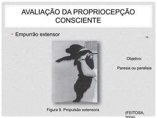 AVALIAÇÃO DA PROPRIOCEPÇÃO 
CONSCIENTE 
• Empurrão extensor 
Figura 9. Propulsão extensora 
(FEITOSA, 
2004) 
24 
Objetivo: 
Paresia ou paralisia 
 