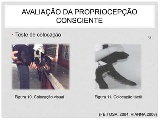 AVALIAÇÃO DA PROPRIOCEPÇÃO 
CONSCIENTE 
• Teste de colocação 
Figura 10. Colocação visual Figura 11. Colocação táctil 
25 
(FEITOSA, 2004; VIANNA,2008) 
 