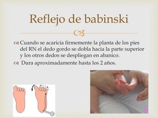 
 Cuando se acaricia firmemente la planta de los pies
del RN el dedo gordo se dobla hacia la parte superior
y los otros dedos se despliegan en abanico.
 Dura aproximadamente hasta los 2 años.
Reflejo de babinski
 