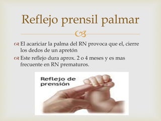 
 El acariciar la palma del RN provoca que el, cierre
los dedos de un apretón
 Este reflejo dura aprox. 2 o 4 meses y es mas
frecuente en RN prematuros.
Reflejo prensil palmar
 