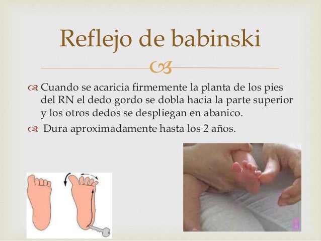 reflejo de babinski pdf converter reflejo de babinski pdf converter