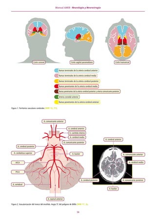 Tema 2 · Enfermedad cerebrovascular
39
• RM: se ve el infarto desde el inicio. Con las nuevas técnicas
de difusión (brilla...
