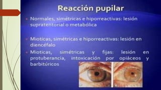 NEUROLOGIA SEMIOLOGICA-  COMA.pptx