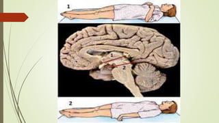 NEUROLOGIA SEMIOLOGICA-  COMA.pptx