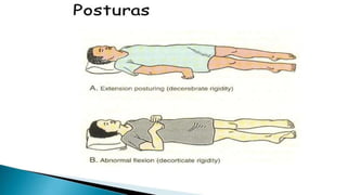 NEUROLOGIA SEMIOLOGICA-  COMA.pptx