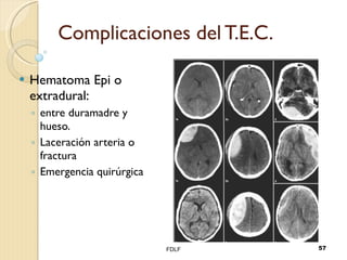 Complicaciones del T.E.C. Hematoma Epi o extradural: entre duramadre y hueso. Laceración arteria o fractura Emergencia quirúrgica FDLF 