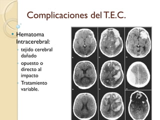 Complicaciones del T.E.C. Hematoma Intracerebral: tejido cerebral dañado opuesto o directo al impacto Tratamiento variable. FDLF 