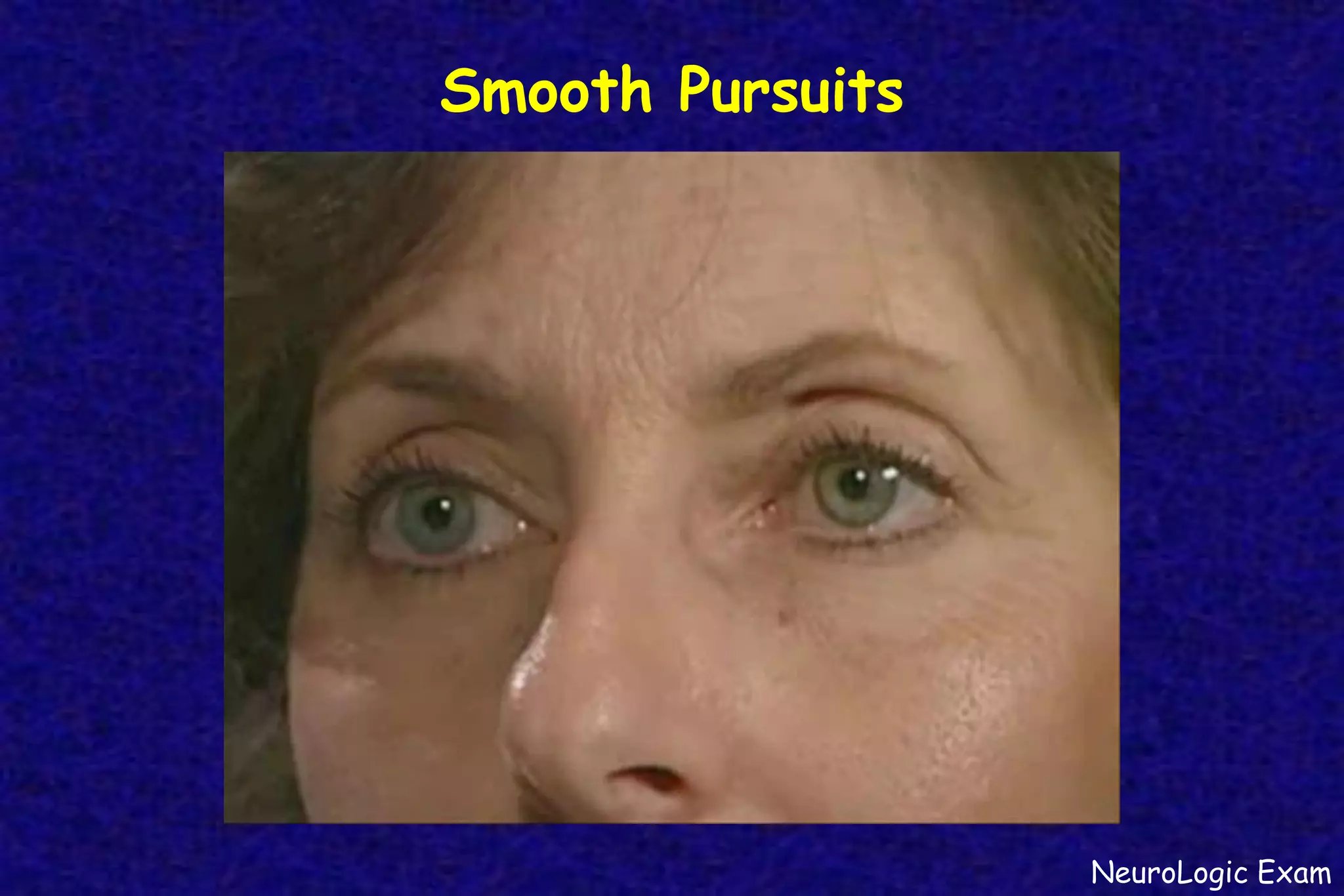 Smooth Pursuits
NeuroLogic Exam
 