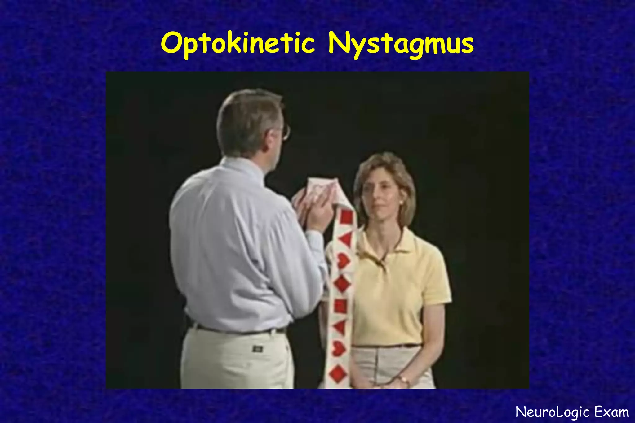 Optokinetic Nystagmus
NeuroLogic Exam
 
